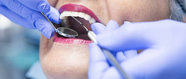 Best Emergency Denture Repair in Laurel Hollow, NY